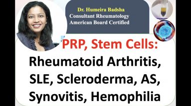 PRP,  Stem Cells: Rheumatoid Arthritis, SLE, Scleroderma, AS,, Synovitis, Haemophilia,