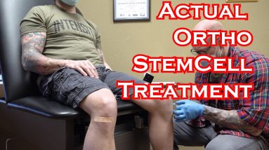 Stem Cell Injection Ortho Treatment Filmed and Explained