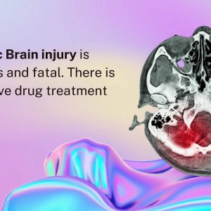 Traumatic Brain Injury | Stem Cell Therapy
