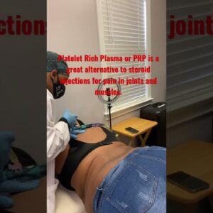 PRP: Platelet Rich Plasma, is it good for joint and back pain?#prp #jointpain #backpain #viral