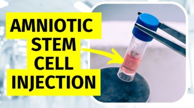 Amniotic Stem Cell Injection for Knee Arthritis