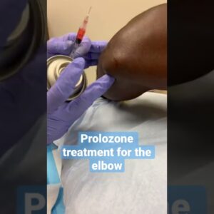 Prolozone is a non evasive alternative treatment that is regenerative medicine