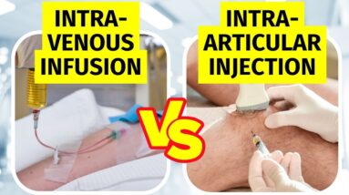 Intravenous (IV) vs Intra-articular Stem Cell Therapy for Knee Arthritis