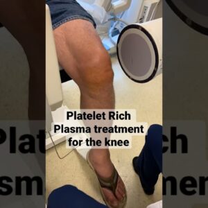Platelet Rich Plasma (PRP)Treatment on the knee