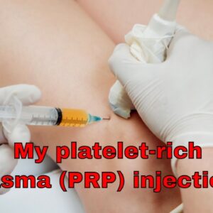 PRP  (Platelet-rich plasma) Treatment