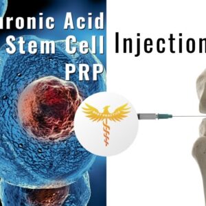 Should you PRP, Stem cells, or hyaluronic acid injection to delay replacement surgery? Updated Audio